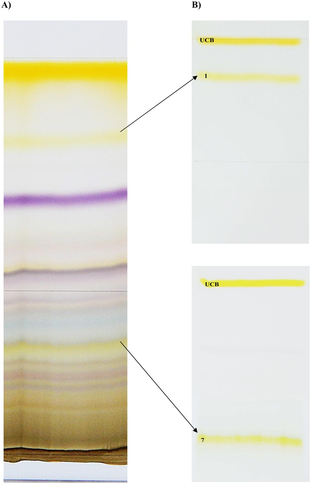 Biological Effects of Bilirubin Photoisomers Fig 2. Compounds produced by bilirubin phototherapy. (A) TLC plate after first chromatography.