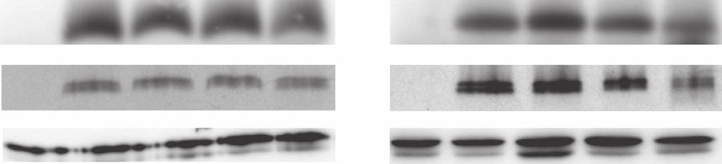 SDHC variant Assembled CII (anti-sdha) SDH activity (PMS) VDAC1 I56F S68A R72C Digitonin B9 WT I56F S68A R72C Lauryl Maltoside B9 WT I56F S68A R72C SQR activity (relative to WT) 2.0 1.5 1.0 0.5 0.