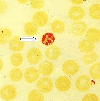 Po několika erytrocytárních generacích nastupuje fáze gametocytogonie. Část populace merozoitů nedorůstá ve schizonty, ale vyvíjí se jiným směrem.