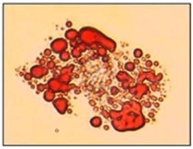že už 48 hodin po migraci monocytů přes vrstvu endoteliálních buněk dojde k jejich přeměně na makrofágy charakteristické velkým počtem lysozomů.