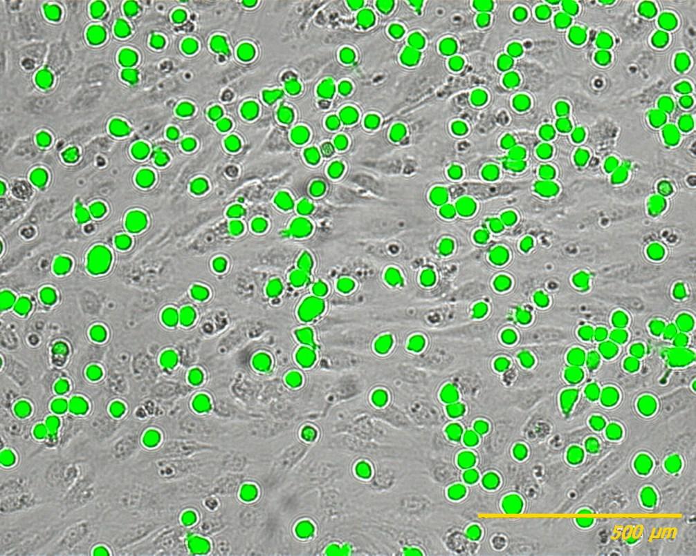 počtu adherovaných buněk při použití 10 ng TNF-α/ml (dolní