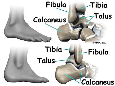 Patní kost (calcaneus ) dorz.- facies articulares talares anterior, media, posterior sulcus calcanei med.- sustentaculum tali (podpírá talus) sulcus tendinis m.