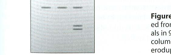 přestavby komparativní genomová hybridizace (CGH) DNA microarraye se