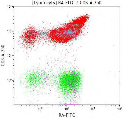 CD2+, CD5+, CD7+ Výlučná