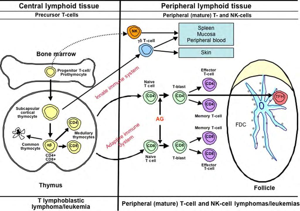 T LYMFOCYTY Classification of lymphoid neoplasms: the