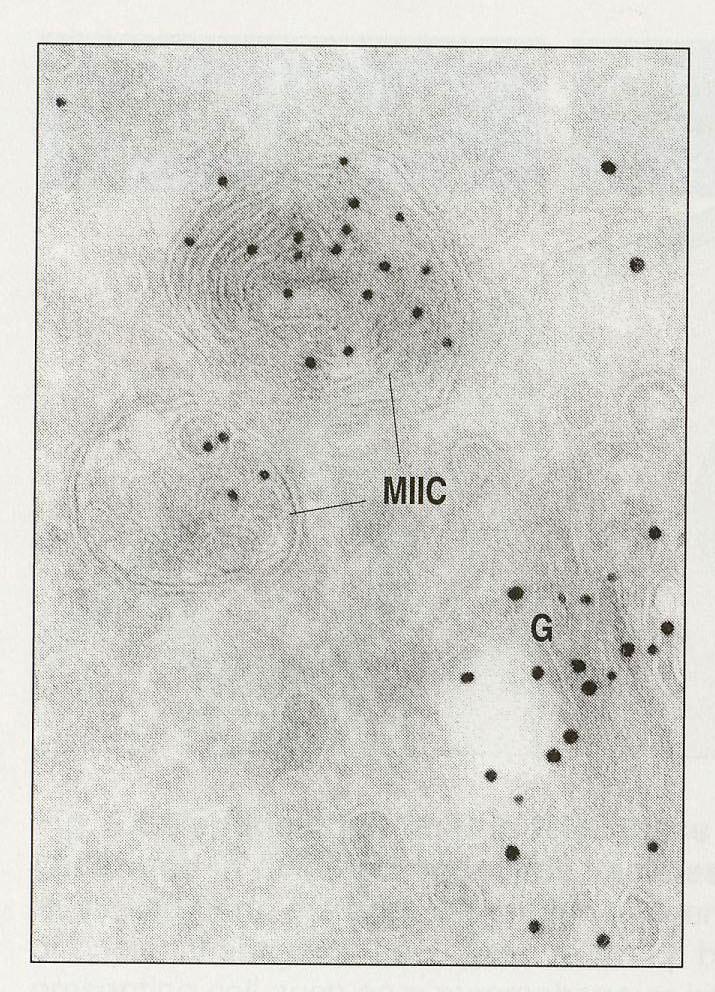 MHC class II are synthetized in ER Through Golgi apparatus are MHC class II transported to the specialized intracellular vesicles, endosome MIIC (MHC class II compartments) In MIIC