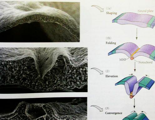 Neurulační dynamika Craniata a Neurální lišta " heterochronie v diferenciaci hlavového úseku, přední a zadní části těla " srv. specifická exprese Hox genů " n.