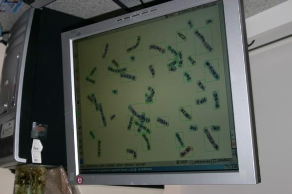 chromosomů a sestavení