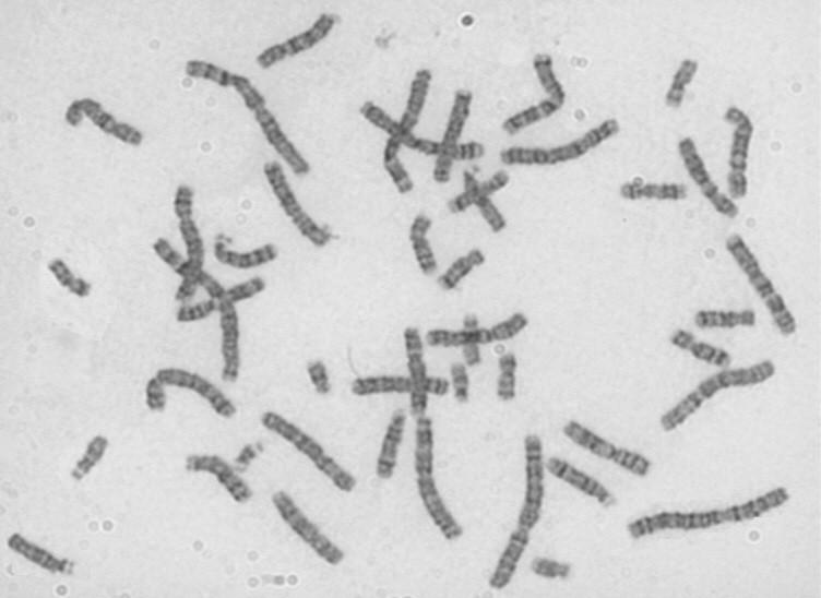 DNA (různé stupně spiralizace) mitóza (metafáze) chromosomy =
