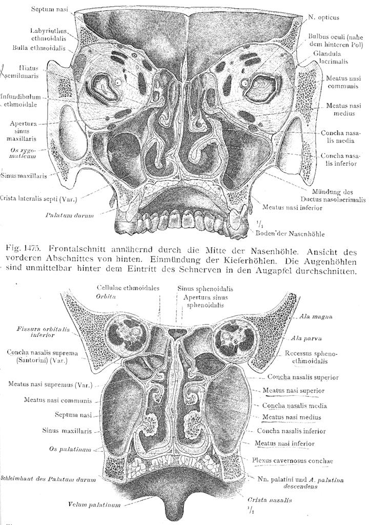 Vztahy dutiny nosní k očnici a nitrolebí. Vlevo concha bullosa, oboustranně bulla ethmoidalis, vpravo processus uncinatus, střední skořepa se upíná k bazi lební.