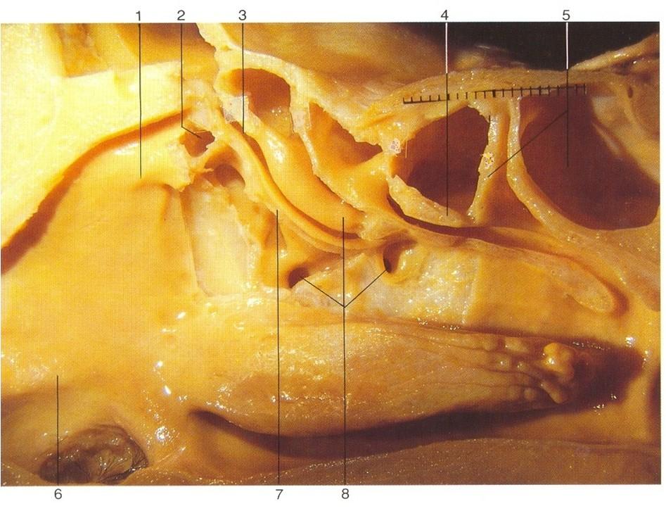 ager nasi ductus nl. hiatus semilunaris úpon c.n.m. c.n.s. rec. sphenoethmoid. + sinus sph. r.s. bulla z.e.. recessus frontalis r.