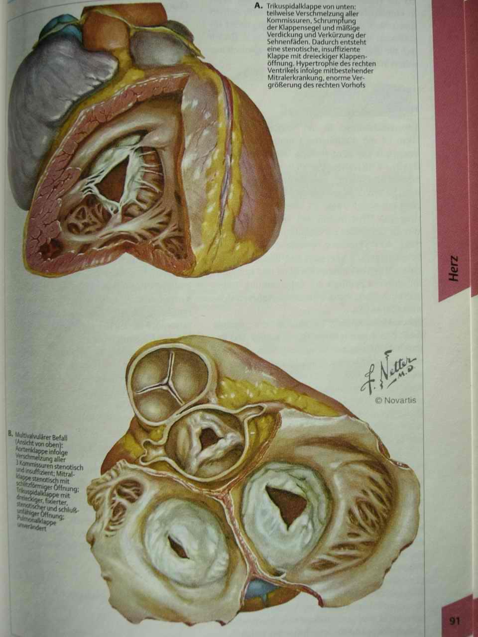 Nedomykavost (regurgitace)