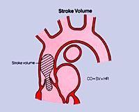 Měření srdečního výdeje CO = SV. HR SV = VTI. CSA CSA = π.