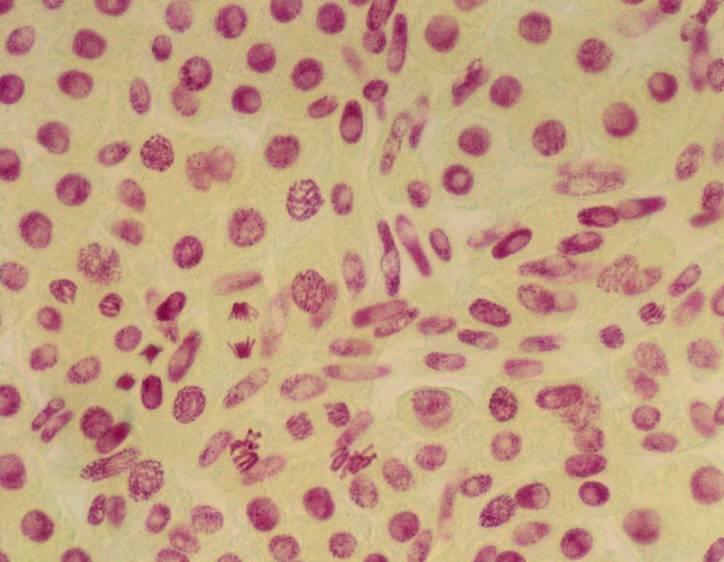 Pozorování chromozomů V. faba suchým objektivem Sklo položte (buňkami nahoru!) na stolek mikroskopu a prohlížejte objektivem o malém zvětšení (4x 10x). Spočítejte 100 buněk a určete mitotický index.