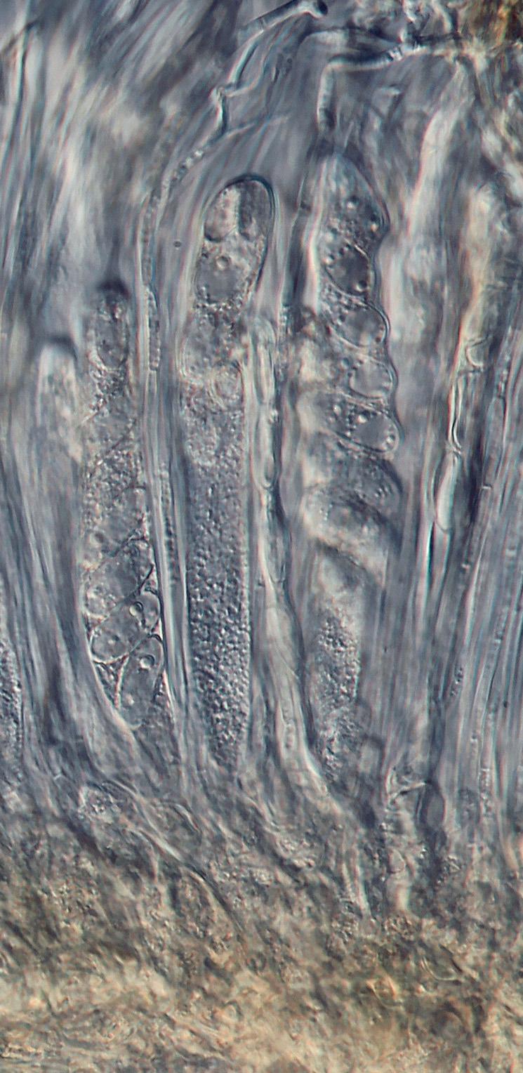 plodnicemi (thallus with