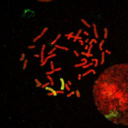 Fluorescenční mikroskopie Lidský chromozóm 8 (FITC) je