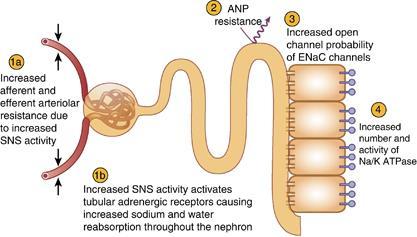 Souhrn natriumretenčních mechanismů 1a aktivity SNS rezistence aferentní a eferentní arterioly 2 Rezistence k ANP 1b aktivity SNS