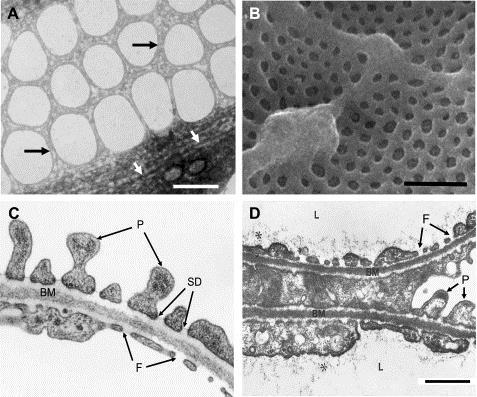 fenestrací glomerulární filtrace proteinurie Satchell &