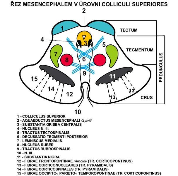 Mezencefalon obecně Mediální mezencefalické sy. léze n.iii,n.