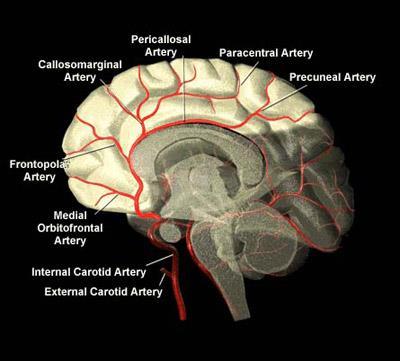 http://www.strokecenter.