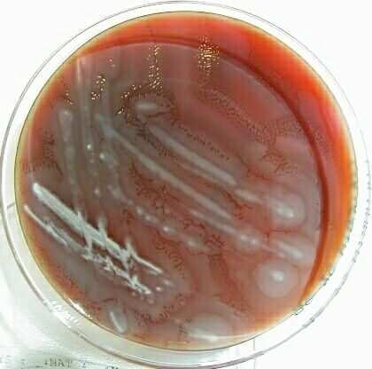 Plazivý mikrob Proteus mirabilis http://www.icbm.