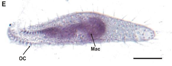 půdě. Somatická ciliatura obvykle uniformní, buněčná ústa
