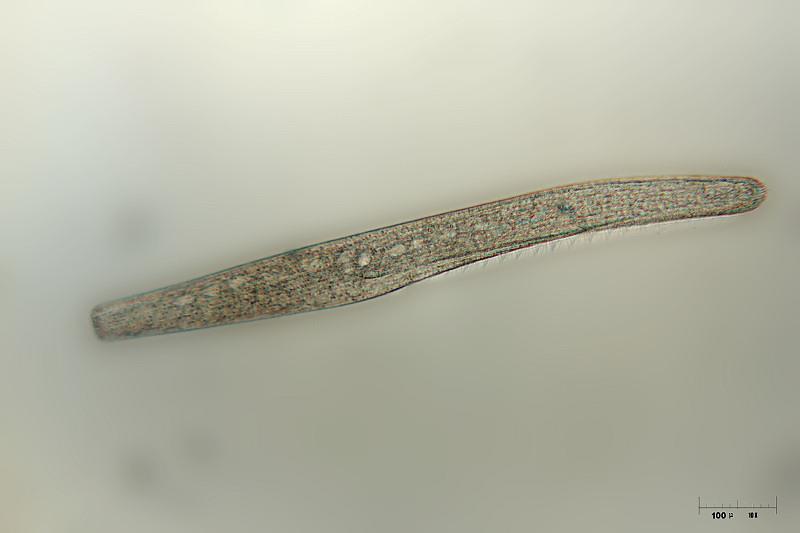 Dinoflagellata (obrněnky) V alveolech mohou obsahovat celulózní destičky. Vzniklý vyztužený povrch se nazývá théka.