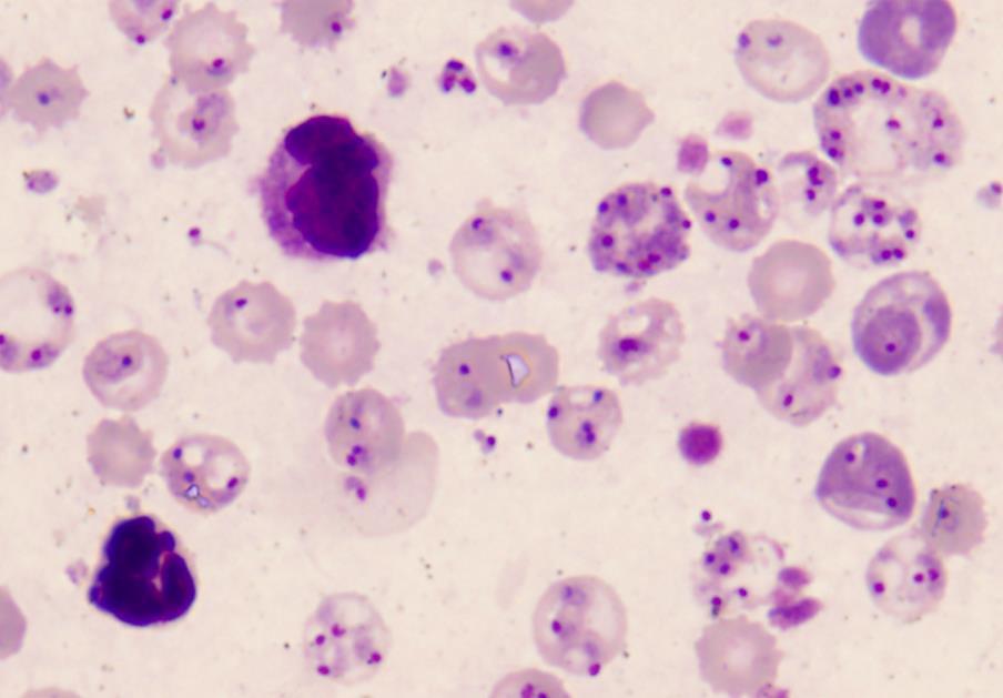 3.4.3. Hematozoea (krvinkovky) Plasmodium berghei parazit hlodavců, přenašečem je komár
