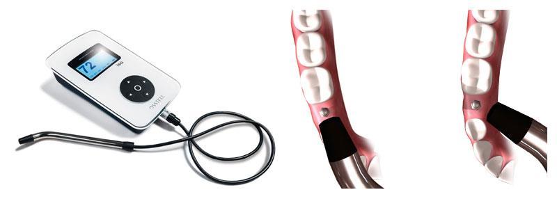 14 Měření stability implantátu Vhojení implantátu je možné diagnostikovat pomocí poklepu kovovým předmětem na fixturu, ale v moderní implantologii je tento způsob nevyhovující.