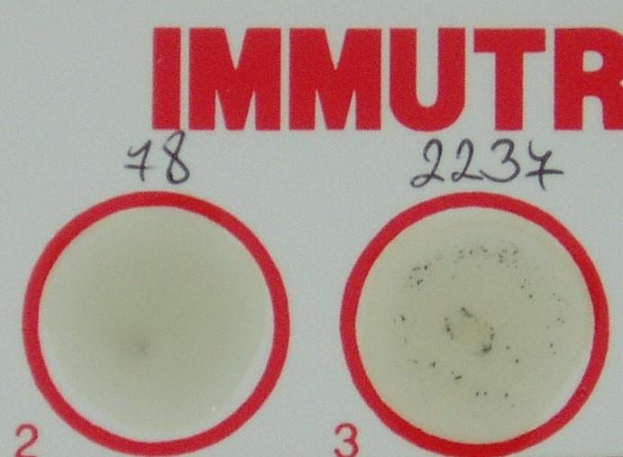 Precipitace antigen koloidní