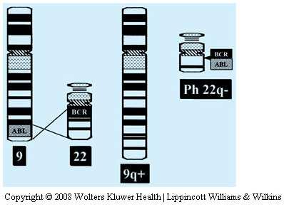 Philadelphia Chromosome