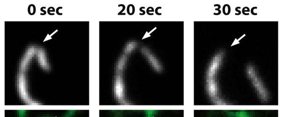 Interakce mitochondrií s ER