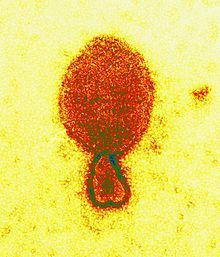 Henipaviry Henipavirus - RNA viry s jednořetězcovou RNA s negativní polaritou Čeleď: Paramyxoviridae
