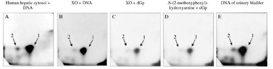 al 2004 a). Inkubací 2-NA s XO a dg (in vitro) vznikají shodné adukty s DNA jako v reakci celého řetězce DNA s XO a 2-NA. (obr 16 C, str.