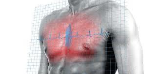 Diagnostika AIM klinický obraz - anamnéza EKG