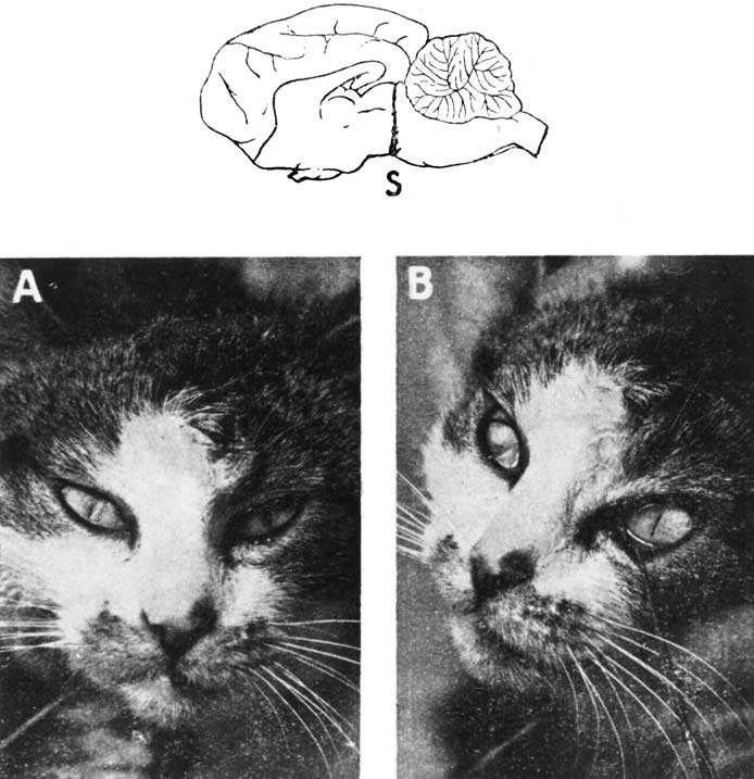 Cerveau isole řez mezi colliculy