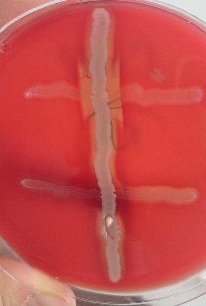 Úkol č. 11: CAMP test (Str. pyogenes x S. agalactiae + S. aureus) Slouží k odlišení β-hemolytických streptokoků a umožní nám odlišit Streptococcus agalctiae od Str. pyogenes. 1. Na krevním agaru skřížíme linie Staph.