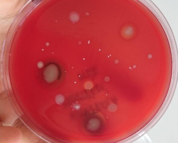 Následující den spočítáme CFU a přepočteme na jednotku času (1 hodina). Výsledek: 44 kolonií / hod Úkol č. 6: Kontrola mikrobiologické čistoty prostředí Zde provedeme 1. Kvalitativní metodu stěr a 2.