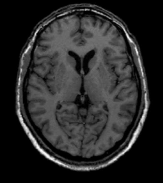 ganglia a