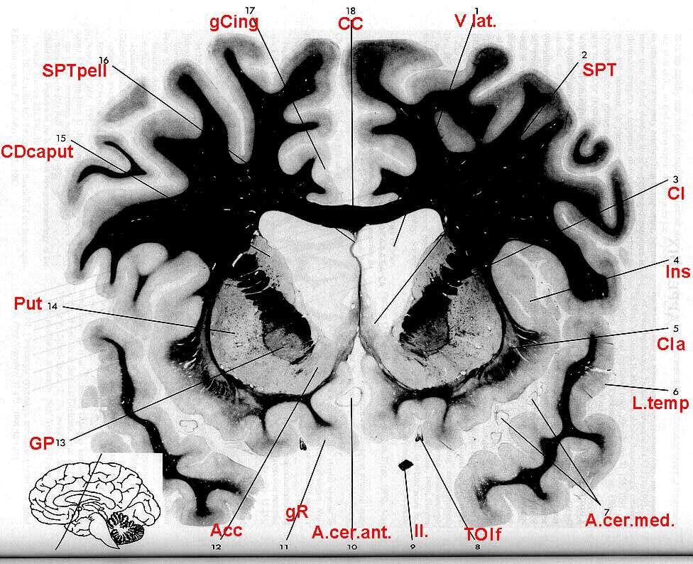 accumbens prefrontální kůra Vzestup hladiny dopaminu při očekávání