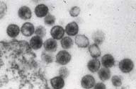chřipky minus ssrna, 8 segmentů, 8 genů, 10 proteinů HIV