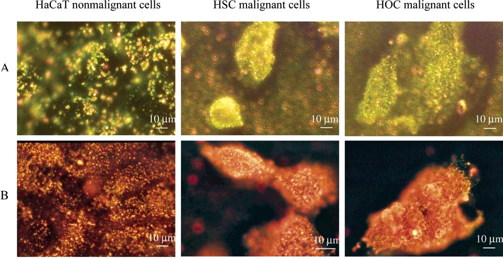 Využití měření rozptylu světla Rozptyl světla na zlatých nanočásticích převyšuje rozptyl záření způsobený biologickým materiálem.