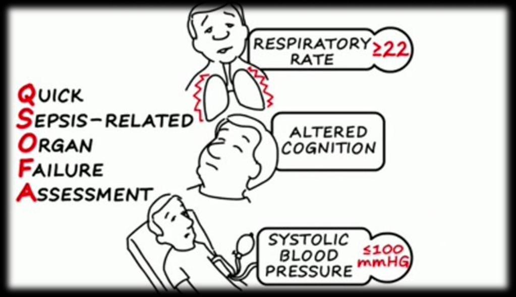 SEPSIS III klinická kritéria pro rychlé bed-side vyhodnocení orgánové dysfunkce mimo ICU Q-SOFA Přítomnost 2 nebo více qsofa