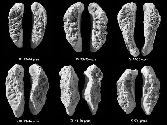 Obrázek 17: facies symphysialis ossis pubis, sloužící k porovnání. Vysvětlení - years - roky (upraveno dle: White et al. 2012, s. 397). 12.2.4.