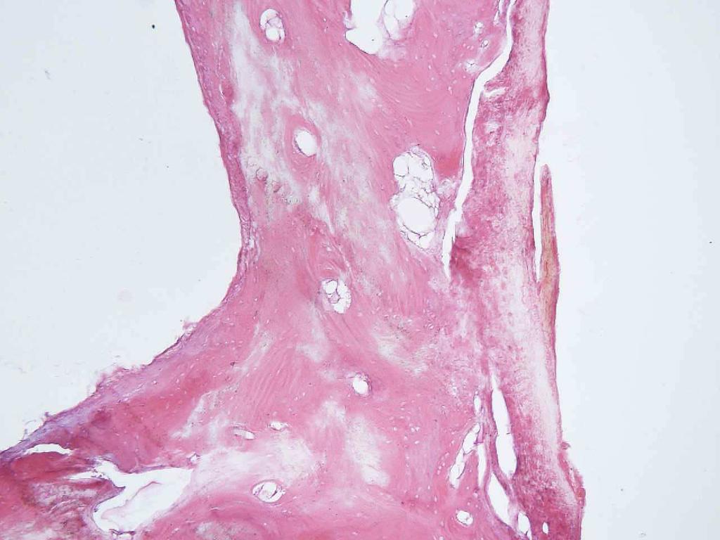 probíhat perzistující stapediální arterie jako rudiment z fetálního vývoje, která je větví z arteria carotis interna.
