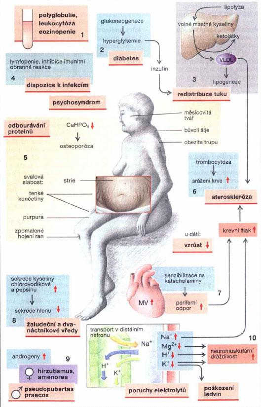 Důsledky a příznaky nadbytku kortikosteroidů Cushingův syndrom