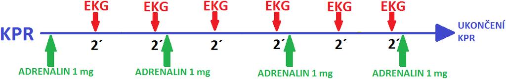 Nedefibrilovatelný rytmus Asystolie bezpulsová elektrická aktivita PEA, zástava oběhu při