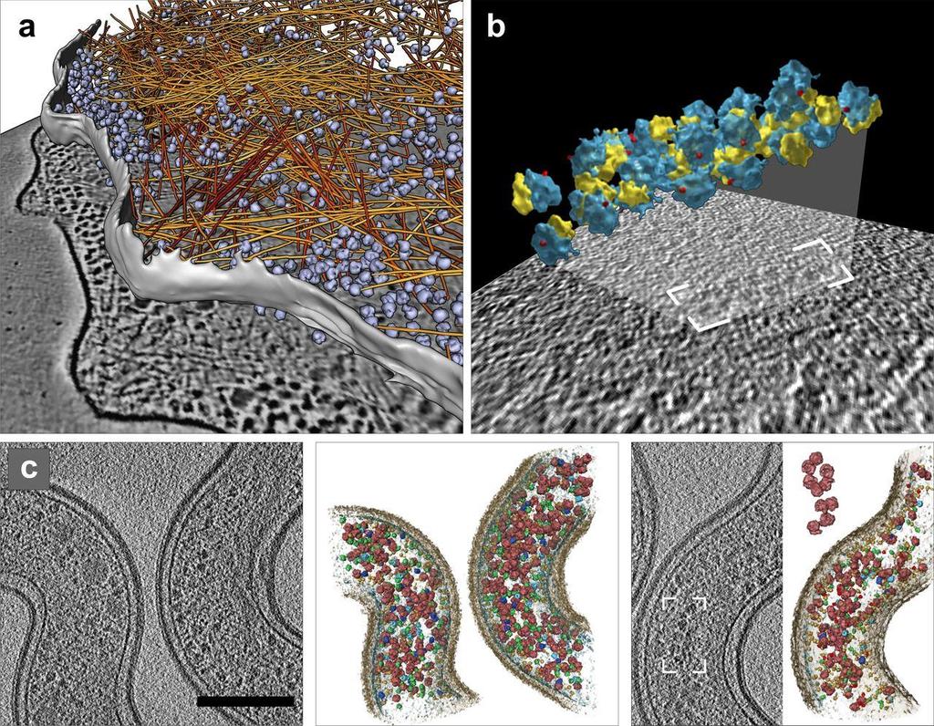 8. Kryogenní elektronová tomografie ukázky tomogramů Aktinová vlákna v Dictyostelium