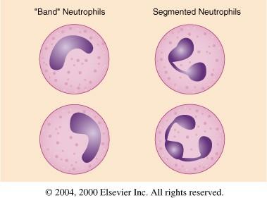 Neutrofilní granulocyty 72 % v DBOK 8 9, v nátěru 10 12 m