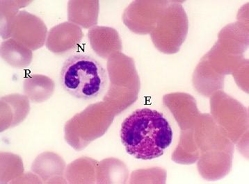 Eosinofilní granulocyty 1 4 % v DBOK 9 10, v nátěru 12 14 m cytoplazma: